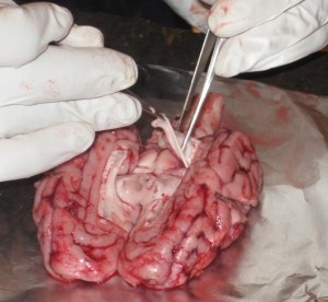 Dissection of a pig brain